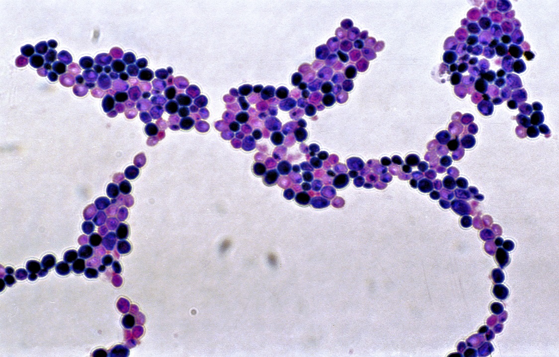 Кандидоз - Лечение продуктами NSP